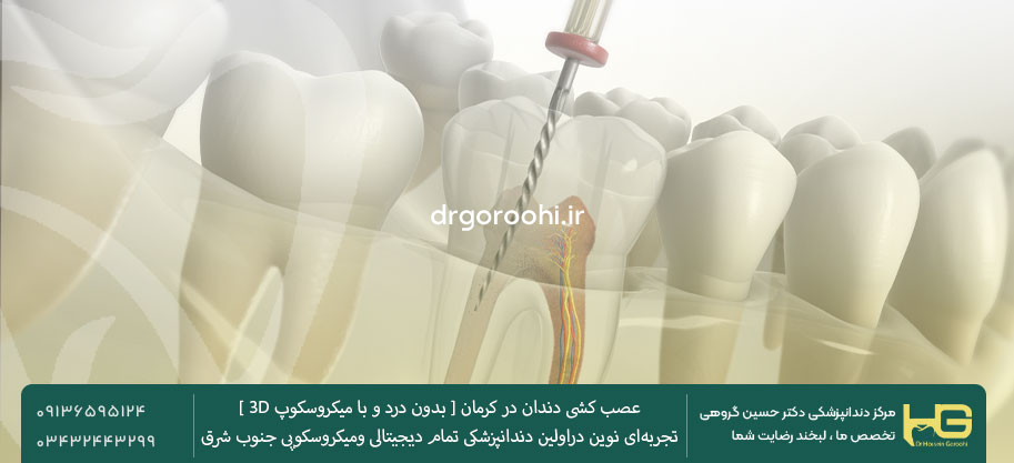 درمان ریشه دندان در کرمان
