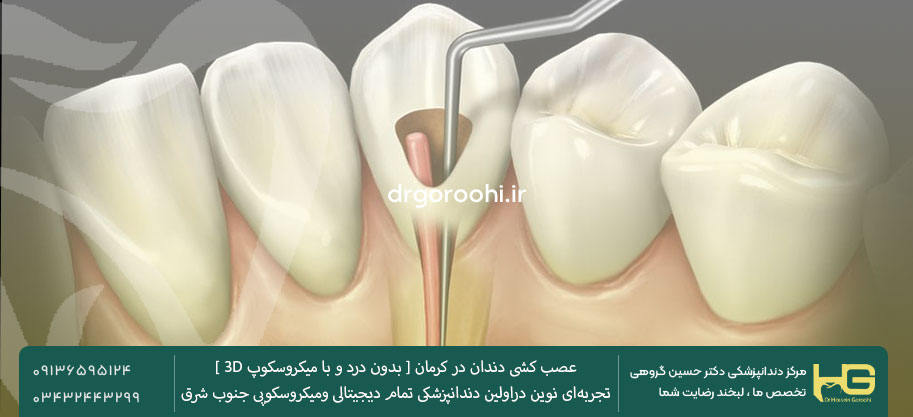 بهترین دندانپزشک عصب کشی در کرمان