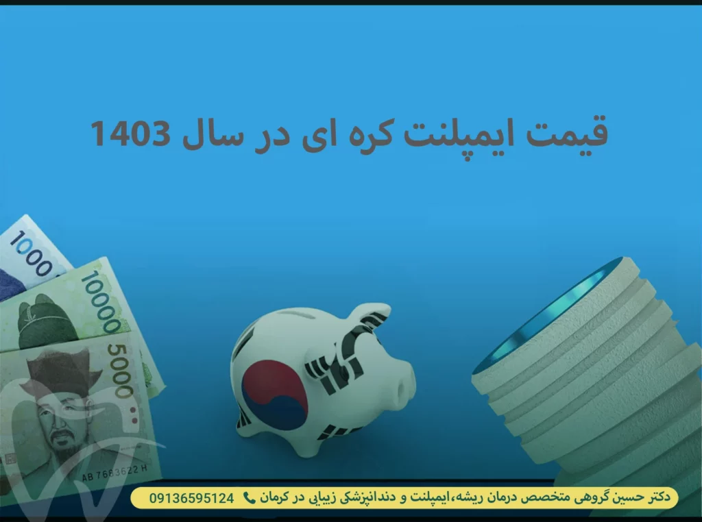 قیمت ایمپلنت کره ای در سال 1403