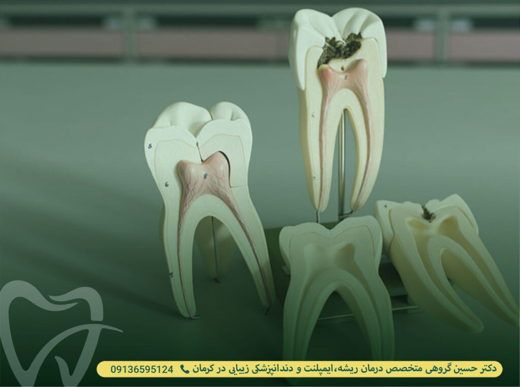 دلایل تشنج بعد از عصب کشی
