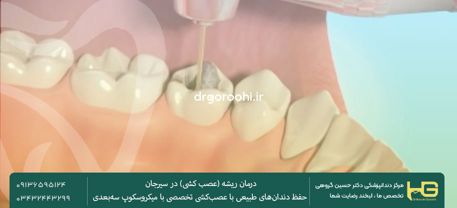 عصب کشی دندان در سیرجان
