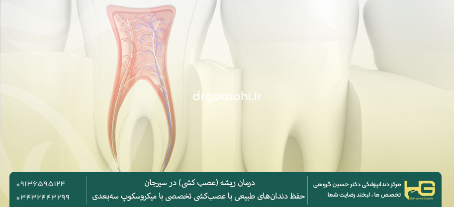 بهترین پزشک درمان ریشه در سیرجان