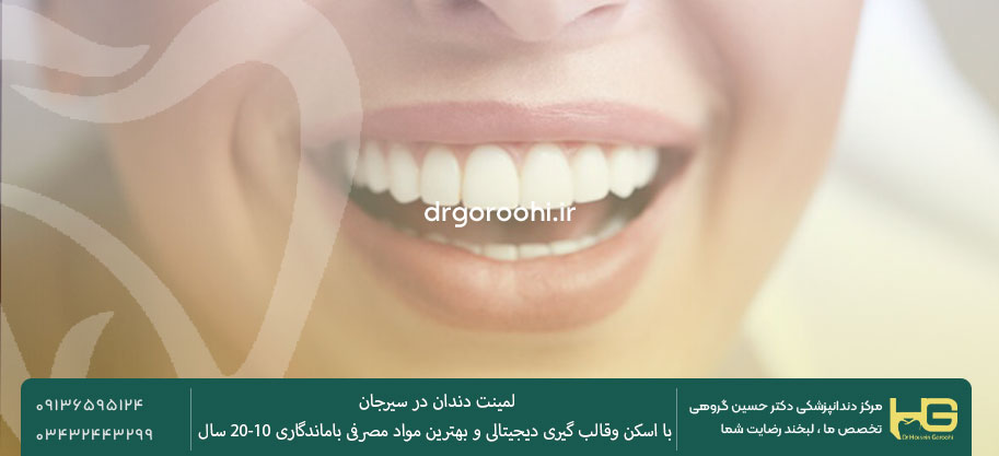 لمینت تمام سرامیکی در سیرجان