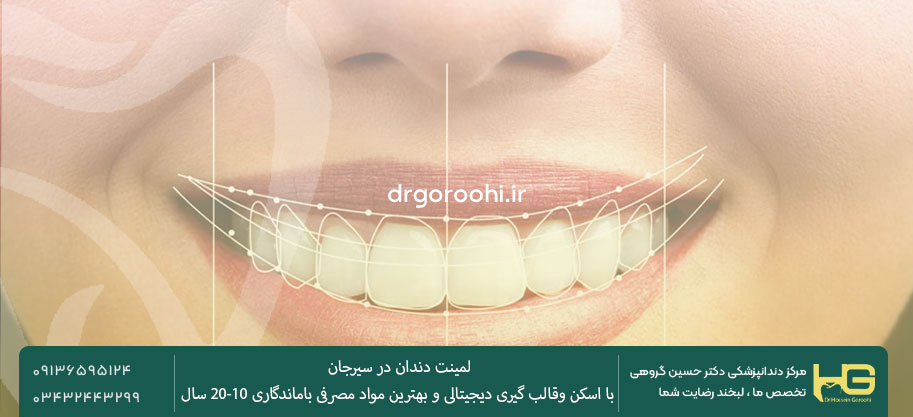 مزایای لمینت دندان در سیرجان توسط دکتر گروهی