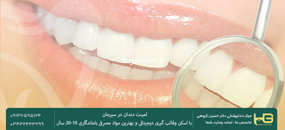 مقایسه لمینت سرامیکی و کامپوزیت