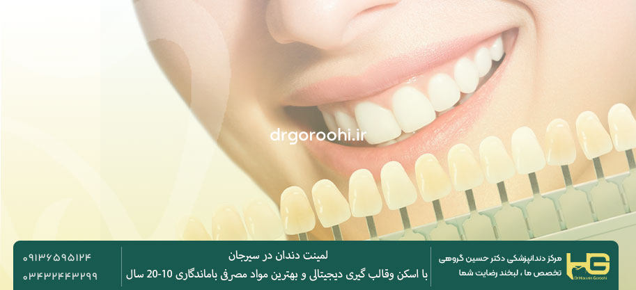 مزایای لمینت دکتر گروهی در سیرجان