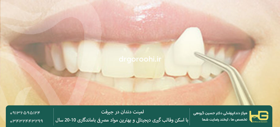 لمینت سرامیکی دندان در جیرفت