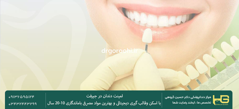 مراحل انجام لمینت دندان در شهر جیرفت توسط دکتر گروهی
