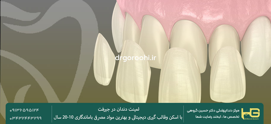 بهترین متخصص لمینت دندان در جیرفت