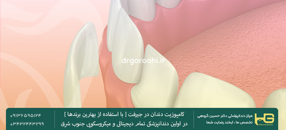 دکتر گروهی بهترین دندانپزشک کامپوزیت دندان در جیرفت