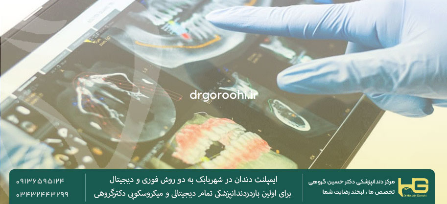 بهترین متخصص ایمپلنت دندان در شهربابک