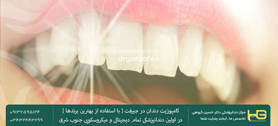 کامپوزیت در جیرفت