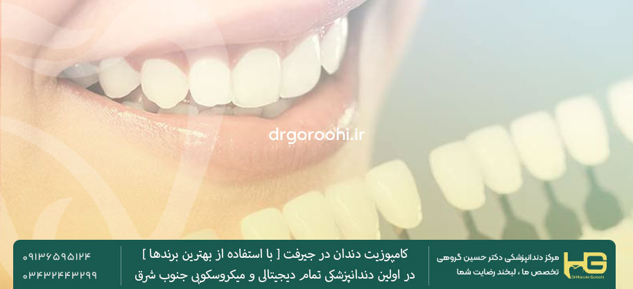 انواع کامپوزیت دندان در جیرفت