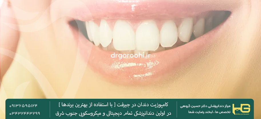 مراحل انجام کامپوزیت دندان دکتر گروهی در جیرفت