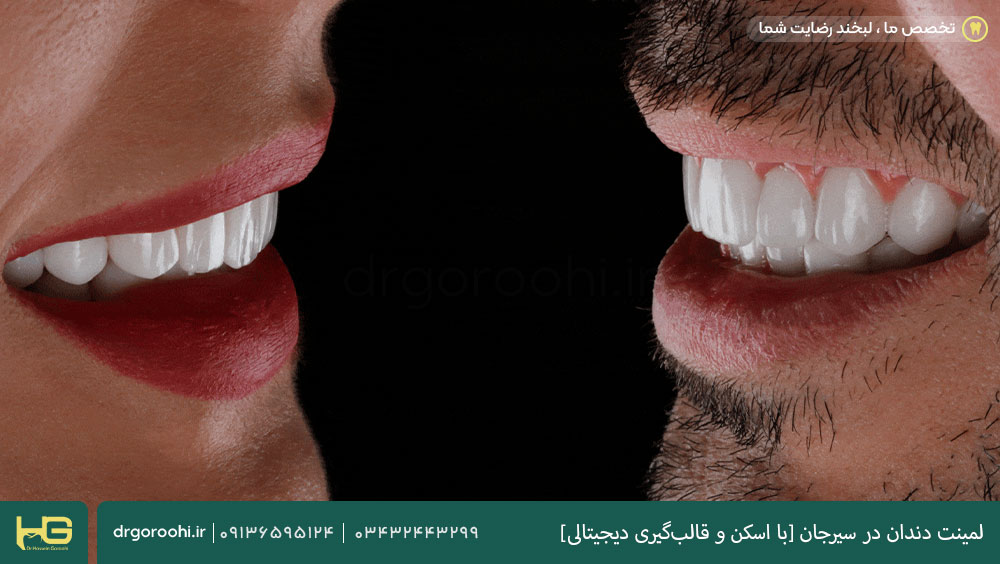 لمینت دندان در سیرجان