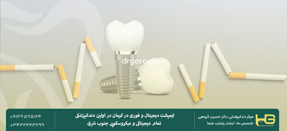 تأثیر سیگار بر روی ایمپلنت دندان