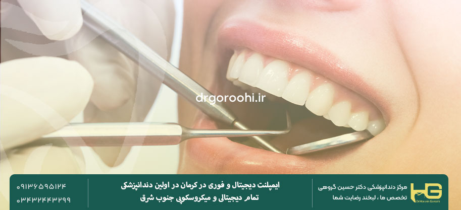 چکاپ‌های سال اول ایمپلنت