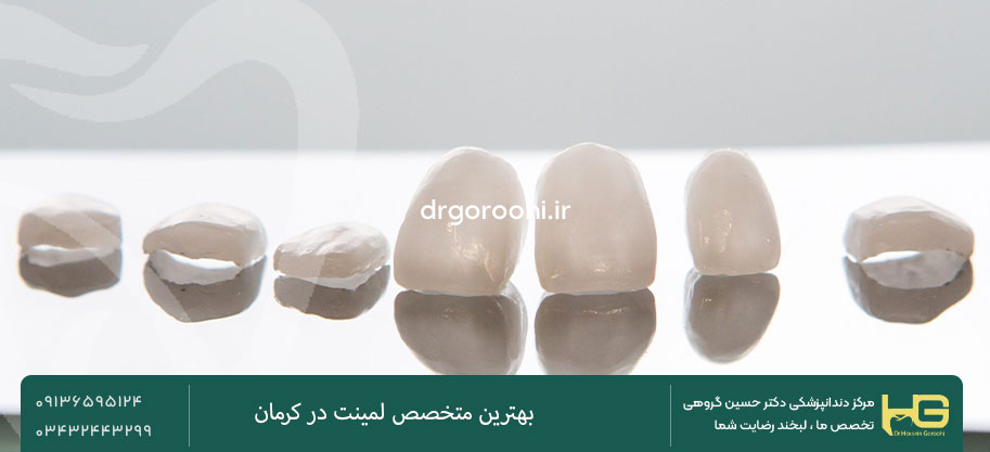 مقایسه روکش زیرکونیا با لمینت سرامیکی از نظر طول عمر