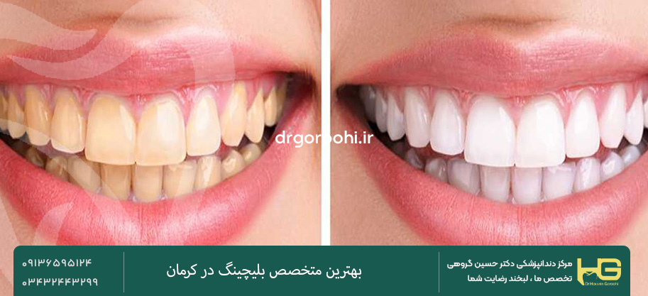 عکس قبل و بعد از بلیچینگ