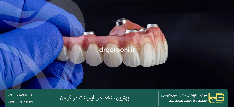 اوردنچر چگونه کار میکند؟
