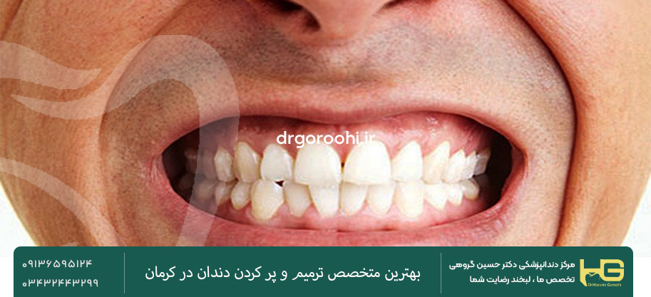 براکسیسم چیست؟
