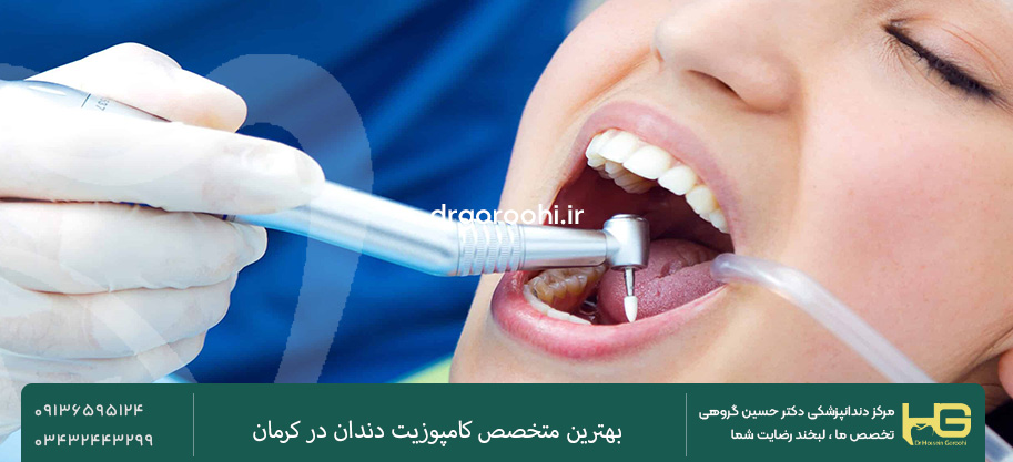 متخصص کامپوزیت دندان در کرمان