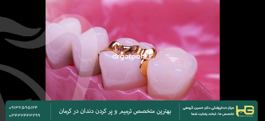 پر کردن دندان با طلا